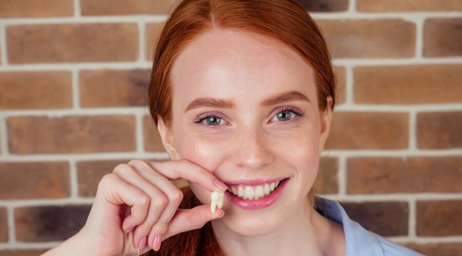 6 mitos e verdades sobre o dente do siso