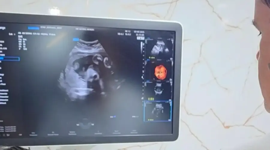 Clínica Móvel Dr. George Morais em Goianésia nesta segunda