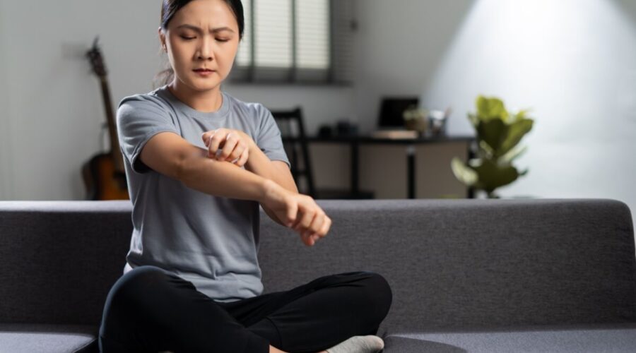 Veja as causas e os tratamentos para urticária